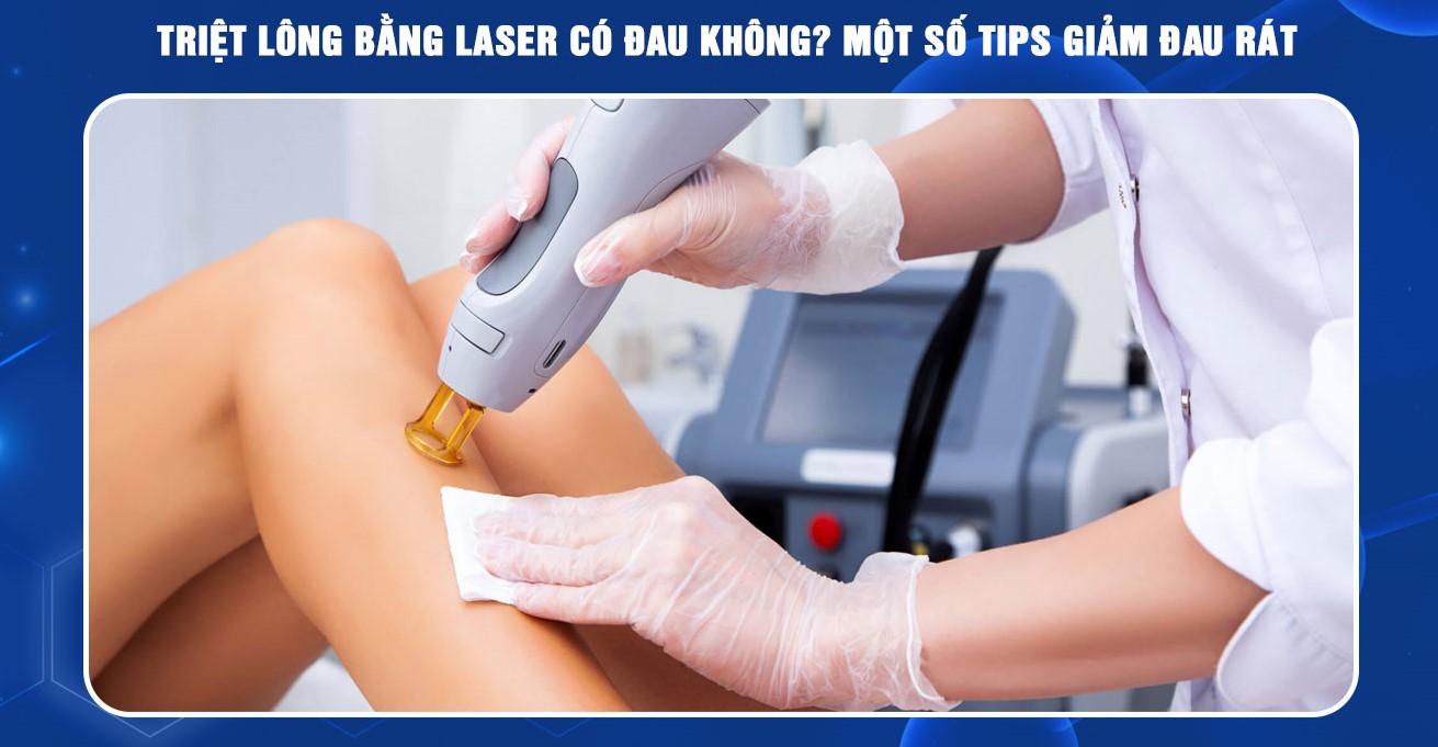 Triệt lông bằng công nghệ Diode laser ruby AI có đau không?